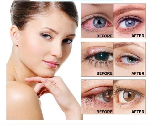 ULTRAEYE™ - Votre Solution Naturelle pour les Problèmes Oculaires