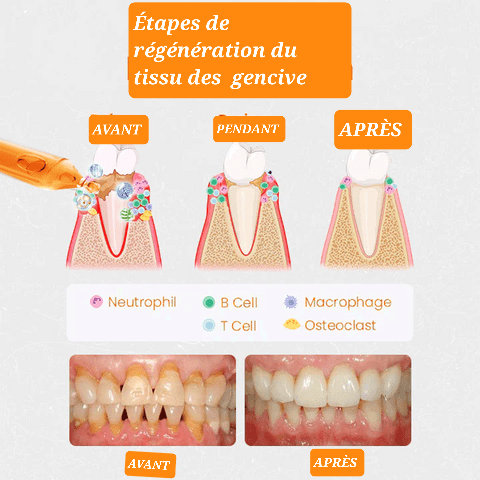 AMPOULES DE RÉPARATION GENCIVES UNPREE™