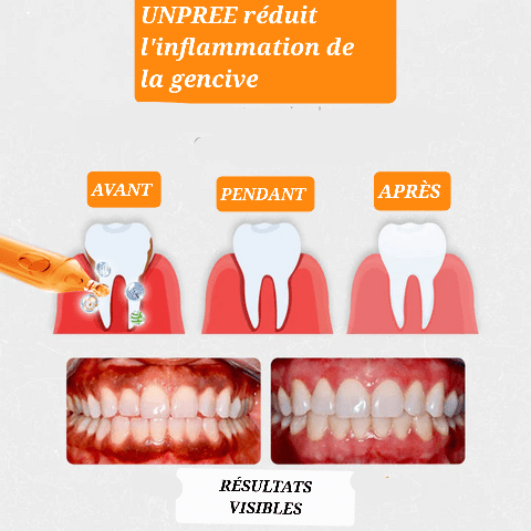 AMPOULES DE RÉPARATION GENCIVES UNPREE™