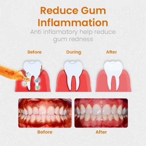 AMPOULES DE RÉPARATION GENCIVES UNPREE™