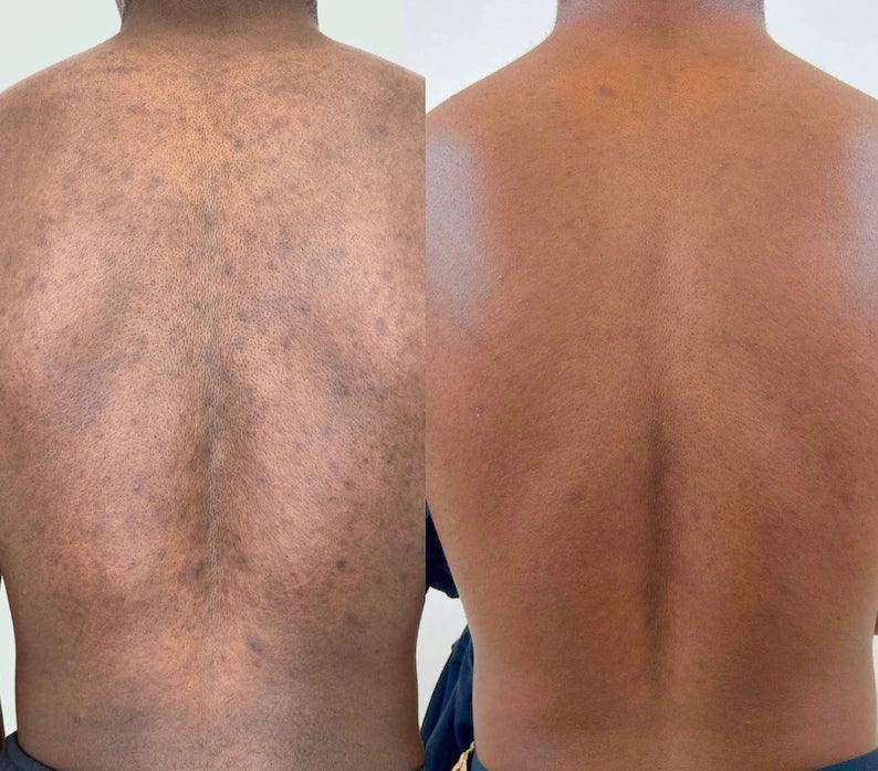 Savon Bioblean au Curcuma ✨ 💥 OFFRE SPÉCIALE : 1 acheté = 1 gratuit ! 💥 STOCK TRÈS LIMITÉ. - Hodamart