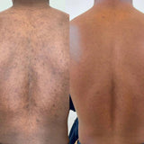 Savon Bioblean au Curcuma ✨ 💥 OFFRE SPÉCIALE : 1 acheté = 1 gratuit ! 💥 STOCK TRÈS LIMITÉ. - Hodamart