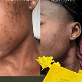 Savon Bioblean au Curcuma ✨ 💥 OFFRE SPÉCIALE : 1 acheté = 1 gratuit ! 💥 STOCK TRÈS LIMITÉ. - Hodamart