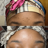 Savon Bioblean au Curcuma ✨ 💥 OFFRE SPÉCIALE : 1 acheté = 1 gratuit ! 💥 STOCK TRÈS LIMITÉ. - Hodamart