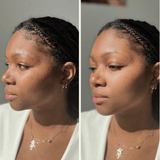 Savon Bioblean au Curcuma ✨ 💥 OFFRE SPÉCIALE : 1 acheté = 1 gratuit ! 💥 STOCK TRÈS LIMITÉ. - Hodamart